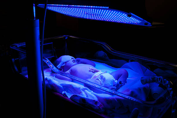 bébé avec phototherapy - yellowing photos et images de collection