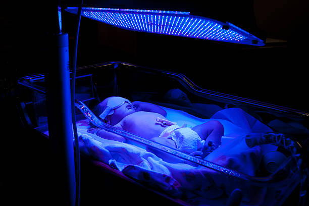 Baby with Phototherapy Newborn baby with neonatal jaundice and high bilirubin hyperbilirubinemia under blue UV light for phototheraphy. light therapy stock pictures, royalty-free photos & images
