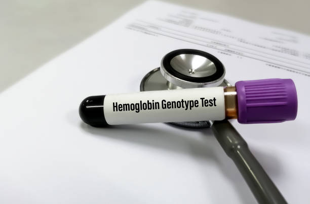 amostra de sangue isolada para teste de genótipo de hemoglobina. diagnóstico de anemia hereditária e talassemia. aa, as, ss e ac - célula alfa - fotografias e filmes do acervo