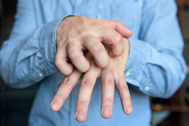 Concept with Healthcare And Medicine. men scratch the itch with hand , men scratch the itch with hand, Concept with Healthcare And Medicine. scab arm stock pictures, royalty-free photos & images