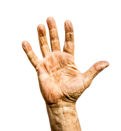 Rough callous hand of working man, open messy human palm isolated on white background