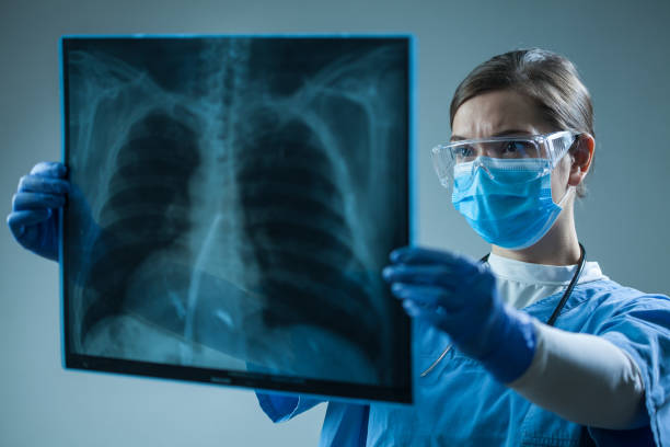 medico donna che guarda la scansione radiografica a raggi x nella stanza del paziente - human lung x ray image x ray human spine foto e immagini stock