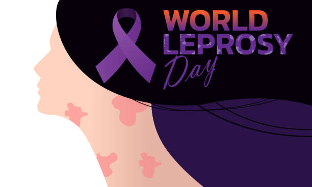 World Leprosy Day Vector illustration on the theme of World Leprosy Day in January mycobacterium leprae stock illustrations