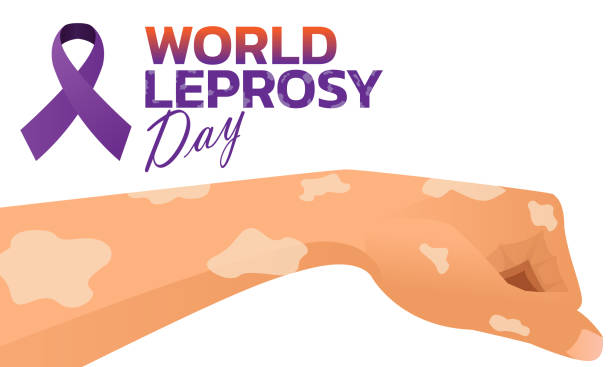 World Leprosy Day Vector illustration on the theme of World Leprosy Day in January leprosy stock illustrations