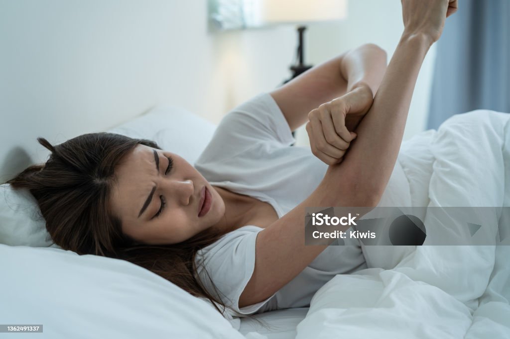 Asian young woman scratch hand feel suffer from allergy while sleeping. Beautiful attractive girl lying on bed in bedroom suffering from itching arm skin allergic reaction to insect bites, dermatitis. Scratching Stock Photo