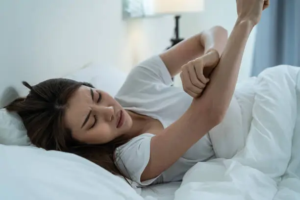 Photo of Asian young woman scratch hand feel suffer from allergy while sleeping. Beautiful attractive girl lying on bed in bedroom suffering from itching arm skin allergic reaction to insect bites, dermatitis.