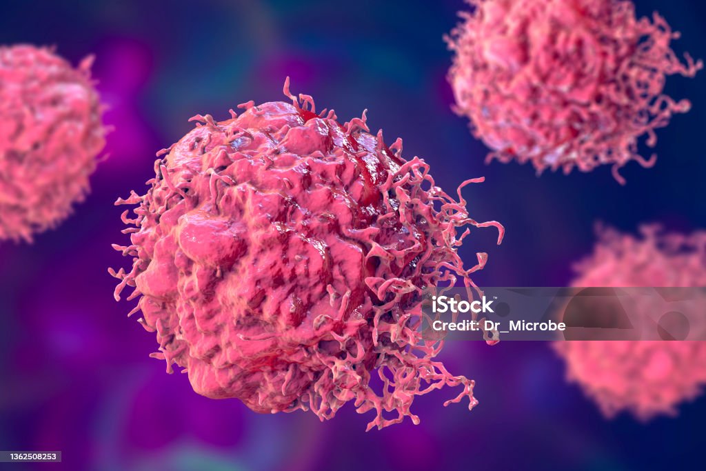 Cancer cells, 3D illustration Cancer cells, malignant cells, scientific 3D illustration Cancer Cell Stock Photo