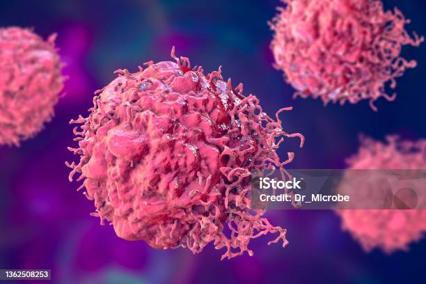 Cancer Cells 3d Illustration Stock Photo - Download Image Now - Cancer Cell, Cancer - Illness, Tumor
