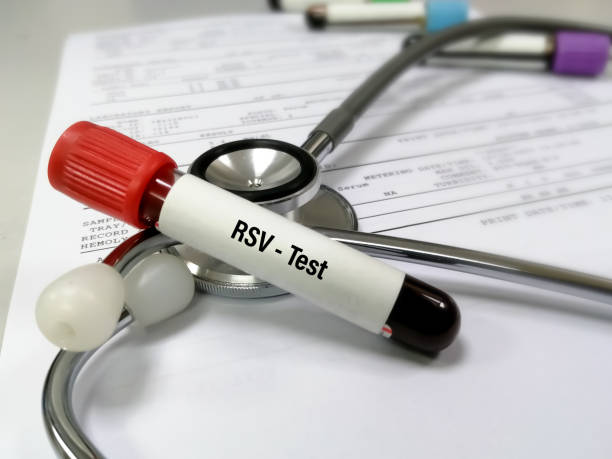 Blood sample for respiratory syncytial virus (RSV) test stock photo
