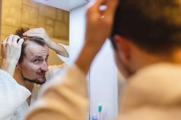 jeune homme en peignoir vérifiant ses motifs chauves dans le miroir de la salle de bain après une douche - toothbrush brushing teeth brushing dental hygiene photos et images de collection