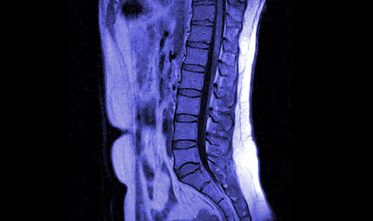 Spinal Cord X-ray Film