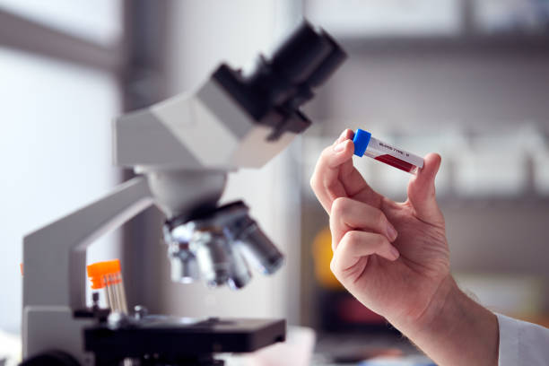 Close-up de trabalhador de laboratório masculino ou phlebotomista analisando amostras de sangue em laboratório com microscópio - foto de acervo
