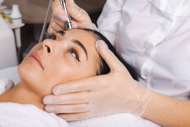 mani cosmetologhe che eseguono la procedura microdermoabrasione della pelle del viso di un cliente presso il salone spa. trattamento della pelle del viso. trattamento di ringiovanimento. cura della pelle. - microdermabrasion foto e immagini stock