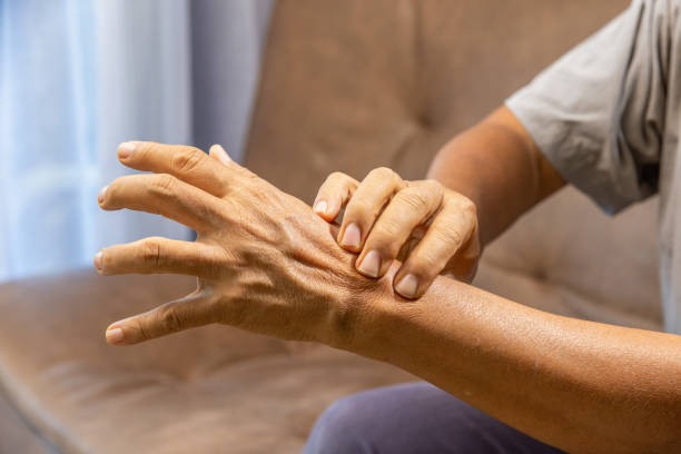 istock Senior man hand suffering from joint pain with gout inflammation 1363534846