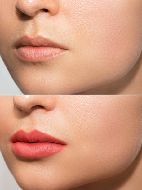istock Female lips after permanent make-up lip blushing procedure 1363681778