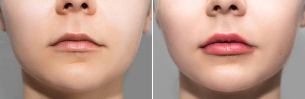 istock Female lips after permanent make-up lip blushing procedure 1363681883
