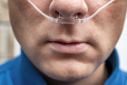 man with nasal tube close-up