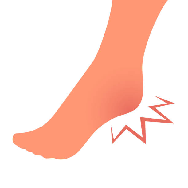 발 뒤꿈치 통증이있는 일러스트 레그 - human foot pain white background isolated stock illustrations