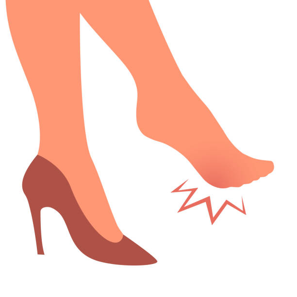 Illustration of a kick in a boot. A woman leg with a sore callus. Transverse flat feet. Orthopedic disease. Foot health problems. High heels. Vector isolated illustration human limb stock illustrations