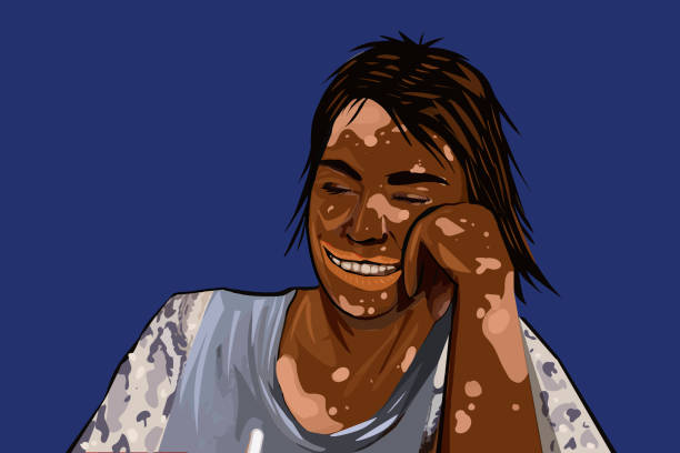 Skin condition is not a problem for me! Smiling woman with skin pigmentation happy about being different and embracing it vitiligo stock illustrations