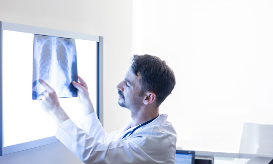 Doctor looking at x-ray of a lung