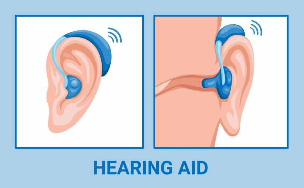 耳補聴器用記号セットイラストベクトル - hearing aid点のイラスト素材／クリップアート素材／マンガ素材／アイコン素材