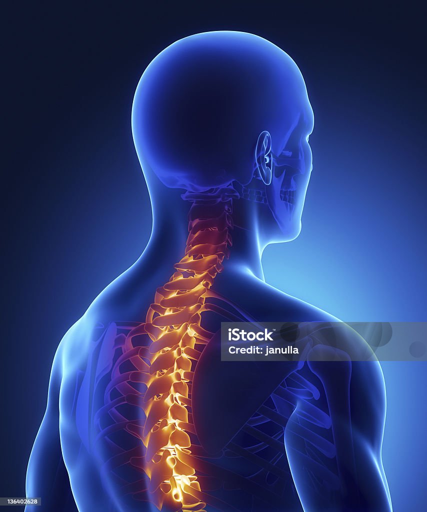 Lesión destacan en la radiografía de la columna vertebral - Foto de stock de Anatomía libre de derechos