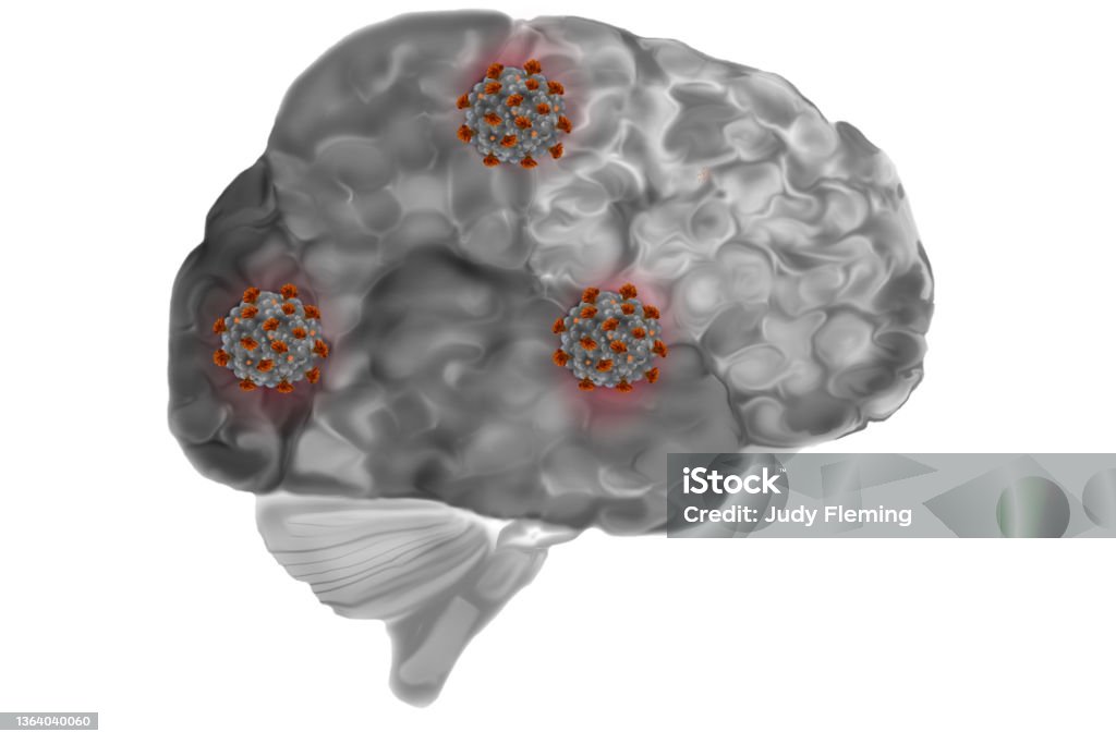 Brain Infected With Covi19 Grey matter or human brain that is infected with coronavirus or covid-19 Research Stock Photo