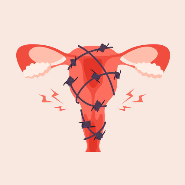 ilustraciones, imágenes clip art, dibujos animados e iconos de stock de concepto de menstruación dolorosa ilustración plana de moda. inflamación del útero, endometriosis, diseño de pancartas. - pms