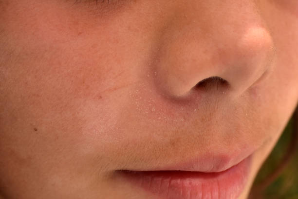 istock sun spots on the skin 1364100867