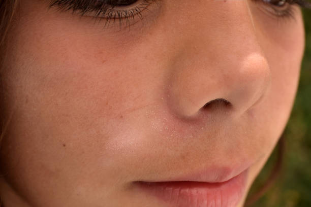 istock sun spots on the skin 1364100872