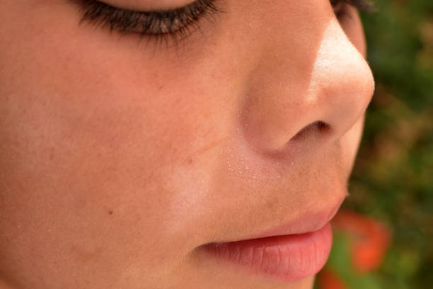 istock sun spots on the skin 1364100909