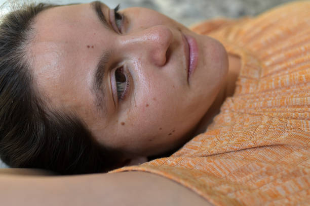 istock woman with moles on her skin 1364101166
