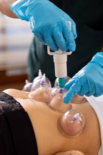 istock A doctor practices acupuncture therapy and vacuum cupping. 1364149385