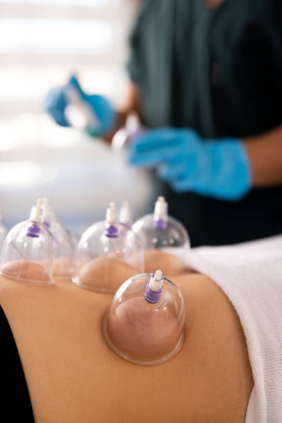 istock A doctor practices acupuncture therapy and vacuum cupping. 1364149640