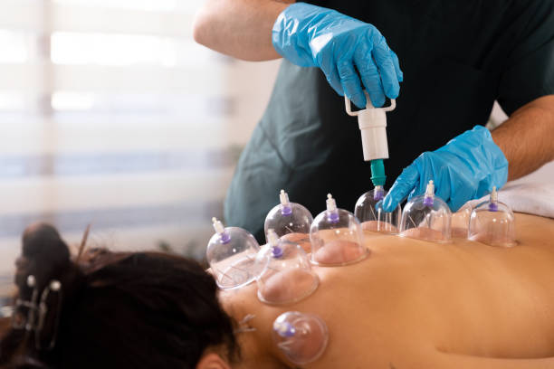 istock A doctor practices acupuncture therapy and vacuum cupping. 1364151406