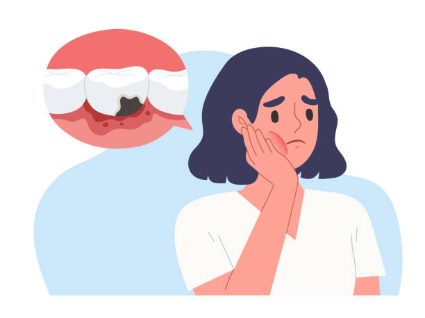 ilustraciones, imágenes clip art, dibujos animados e iconos de stock de mujer joven sosteniendo su mejilla con la palma de la mano. sufrir de dolor de muelas. diente cariado causa de enfermedad oral. concepto de salud bucal, problema dental. - filling