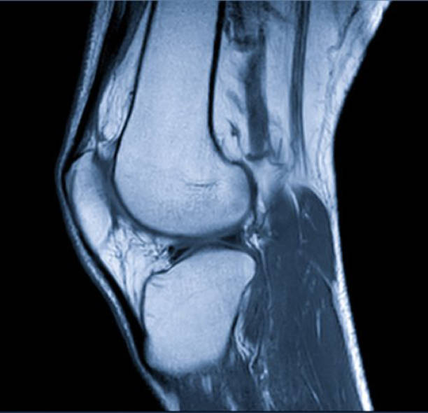 Medical imaging Magnetic Resonance images of The Knee joint Sagittal Proton density Images (MRI Knee joint) showing the anatomy of the knee x ray image medical occupation technician nurse stock pictures, royalty-free photos & images