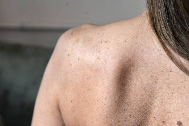 istock Woman from the back 1364572415
