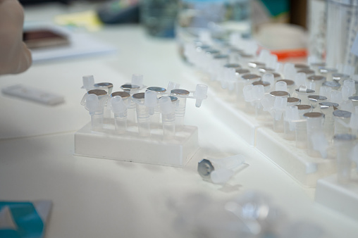 Close up of liquid vials and rapid antigen testing kit on the desk for Covid 19/Coronavirus testing.
