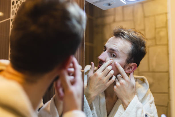 istock Young man in a bathrobe popping pimples while looking at himself in the mirror after a shower 1364642575