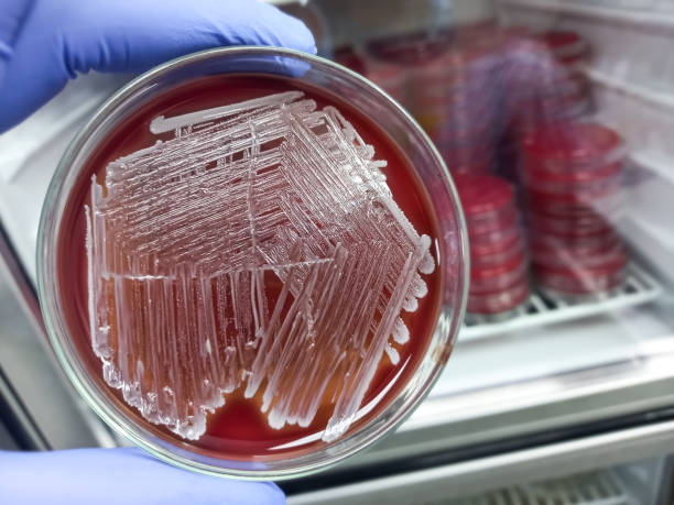 istock Colonies of bacteria in petri dish (blood agar), mixed bacterial colonies 1364705220
