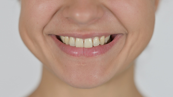 Close up of Smiling Mouth of Indian Woman on White Background