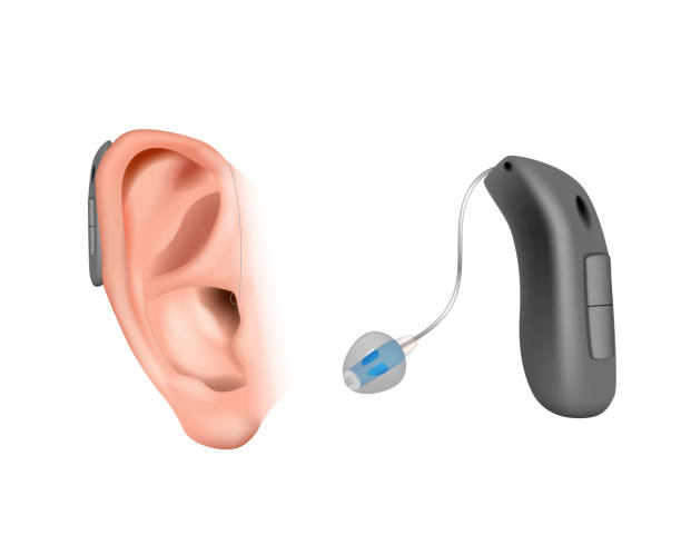 外部受信機とのbteディビス。耳の後ろの補聴器。耳鼻咽喉科における治療と補間薬リアリスティック ベクターのイラスト - hearing aid点のイラスト素材／クリップアート素材／マンガ素材／アイコン素材