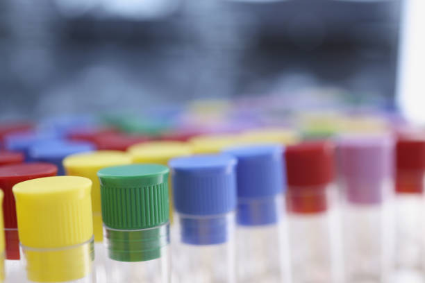 Close-up of glass test tubes with colourful covers. Material in flasks. Medicine analysis and scientific research. Modern laboratory science and chemistry concept