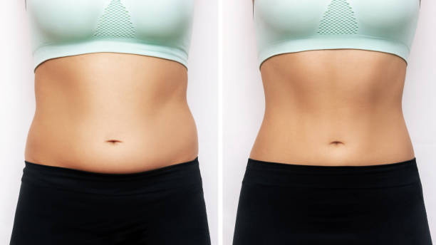a woman's belly with excess fat and toned slim stomach with abs before and after losing weight - buik stockfoto's en -beelden