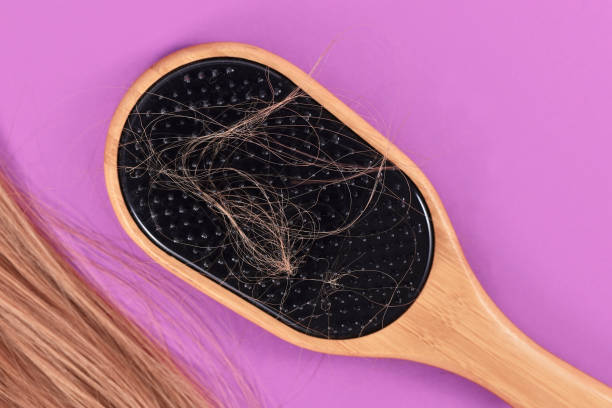 istock Concept for losing hair 1365008751