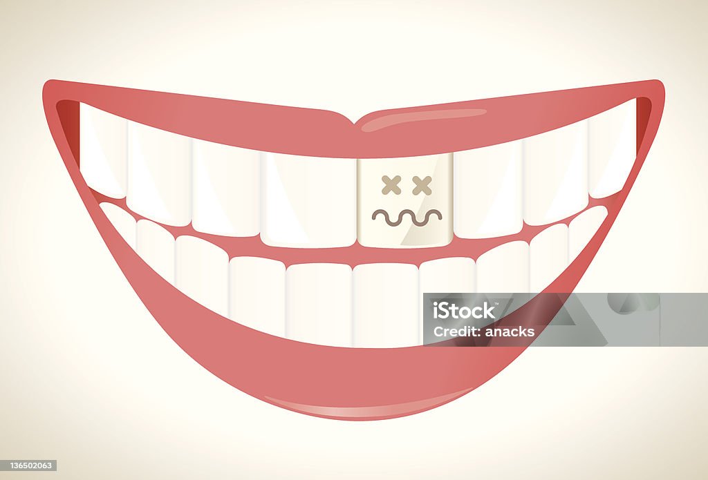 Rotten dents - clipart vectoriel de Antihygiénique libre de droits