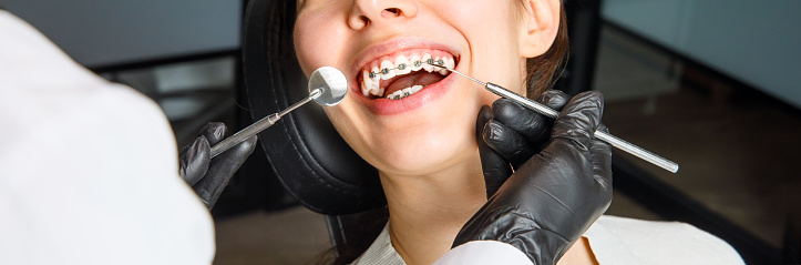 Una mujer joven con aparatos ortopédicos de metal está siendo examinada por un ortodoncista. Corrección de la mordida de dientes en la clínica dental. Concepto de dientes sanos. estandarte photo