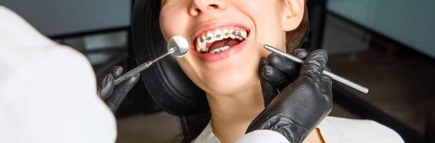금속 중괄호를 가진 젊은 여성이 치열 교정에 의해 검사되고 있습니다. 치과 진료소에서 치아를 물린 교정. 건강한 치아의 개념. 기치 - 버팀대 뉴스 사진 이미지